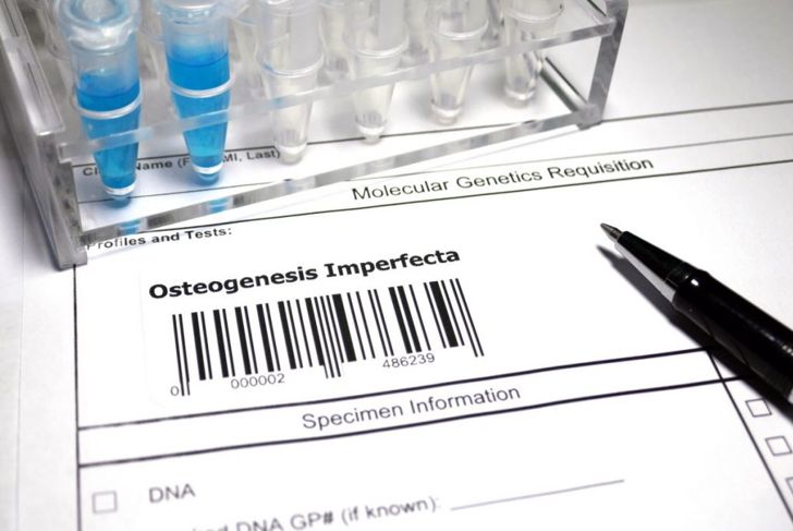 What is Osteogenesis Imperfecta?