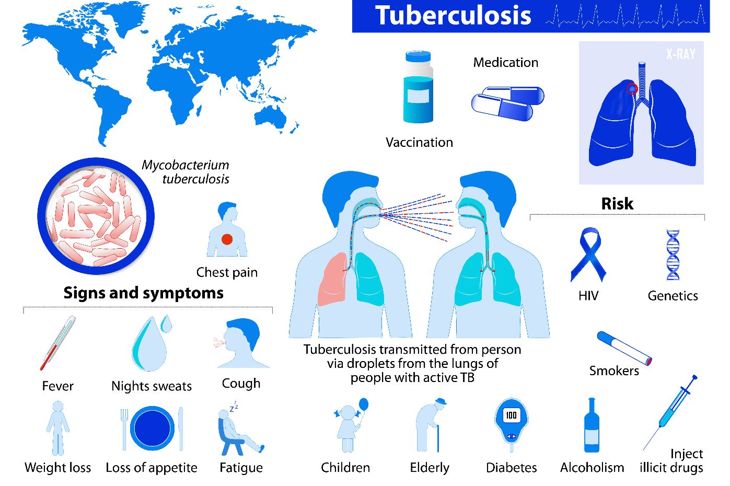 What is Pulmonary Tuberculosis?