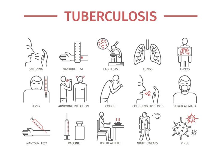 What is Pulmonary Tuberculosis?