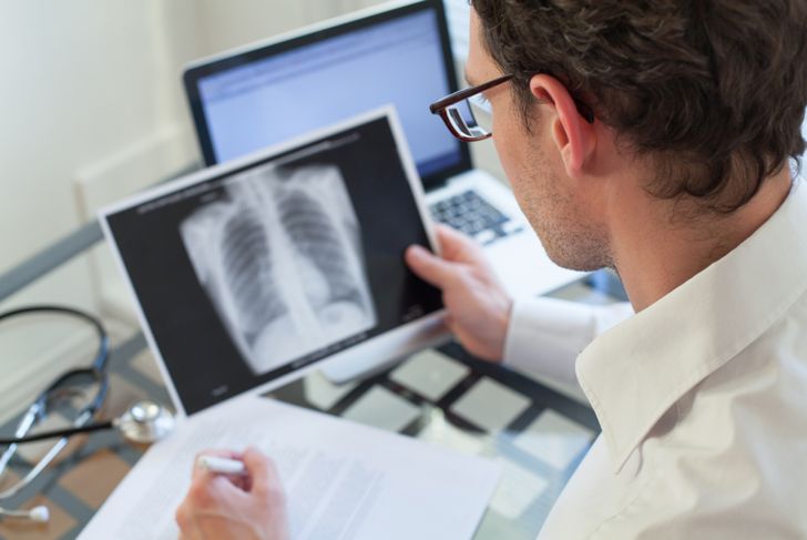 What is Small Cell Lung Cancer?