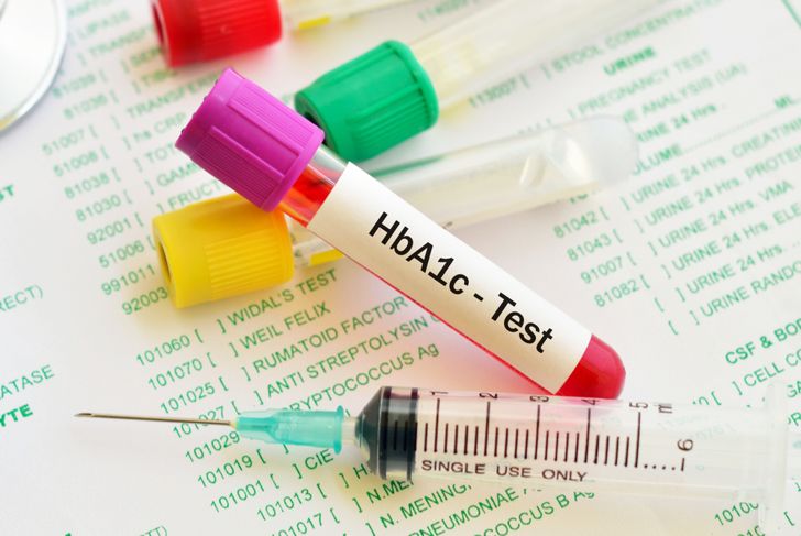 What is the A1C Test?