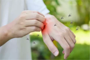 What are the Symptoms of Dengue and the Treatment for Dengue?