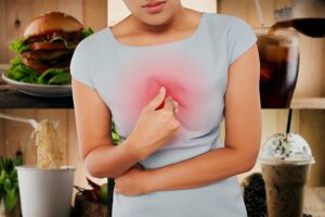 What are the Symptoms of Acid Reflux and the Treatment for Acid Reflux?
