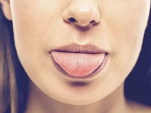What are the Symptoms of Metallic Taste in Mouth Pregnancy and the Treatment for Metallic Taste in Mouth Pregnancy?