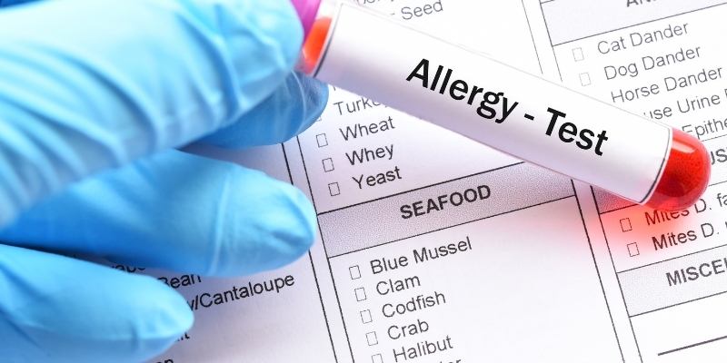 What are the Symptoms of Food Allergy and the Treatment for Food Allergy?