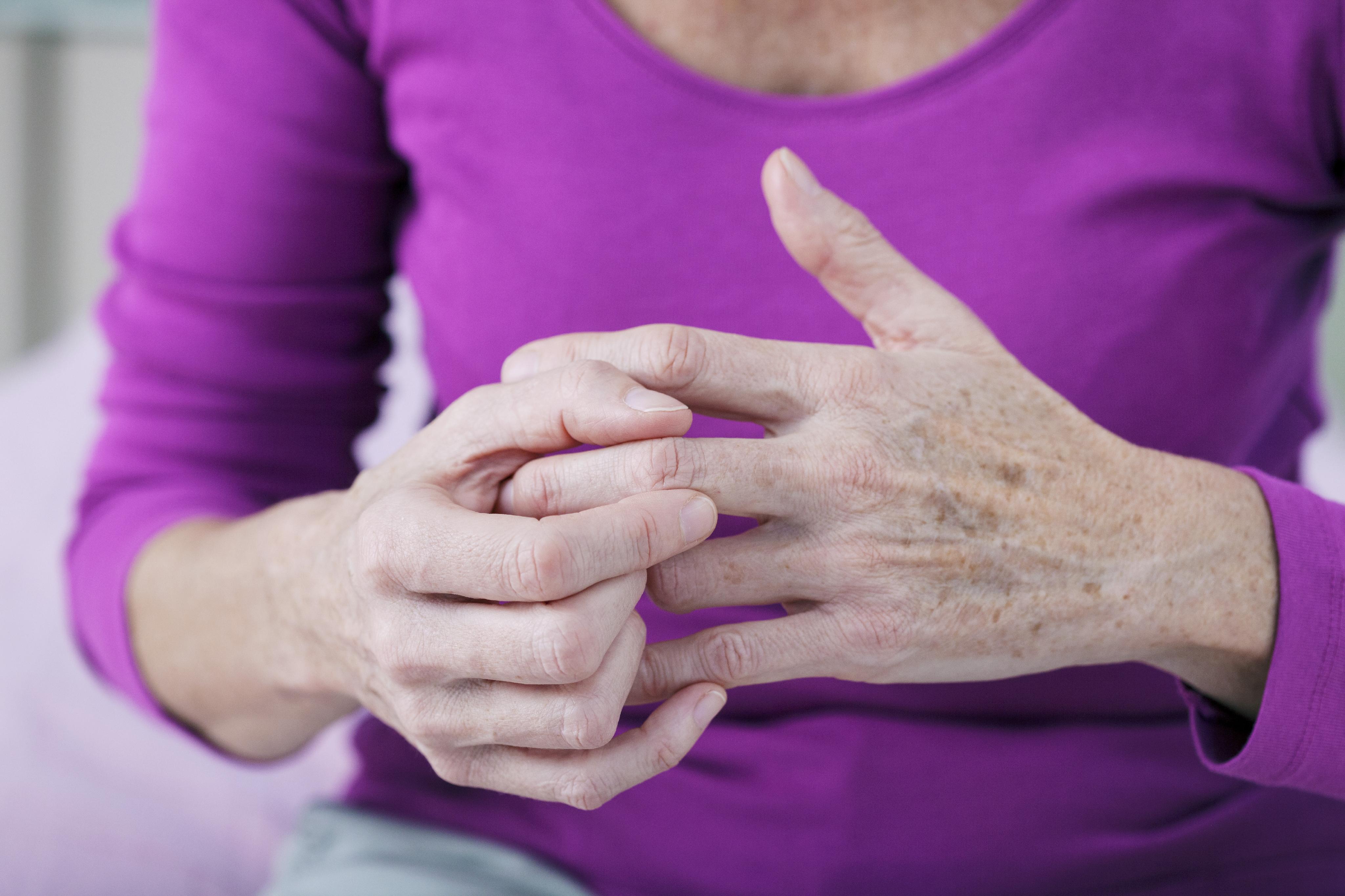 What are the Symptoms of Arthritis and the Treatment for Arthritis?