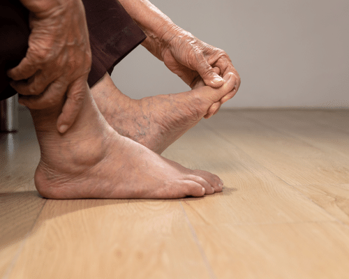 What are the Symptoms of Peripheral Neuropathy and the Treatment for Peripheral Neuropathy ?