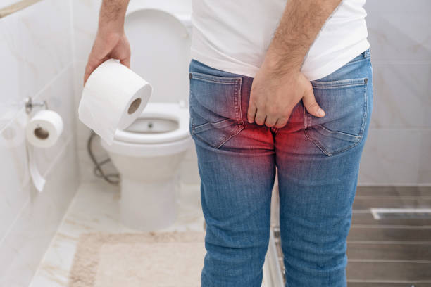 What are the Symptoms and Signs of Hemorrhoids and the Treatment for Hemorrhoids?