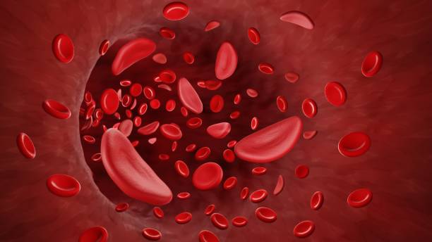 What are the Symptoms of Sickle Cell and the Treatment for Sickle Cell?