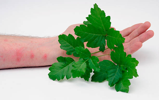 What are the Symptoms of Poison Ivy and the Treatment for Poison Ivy?