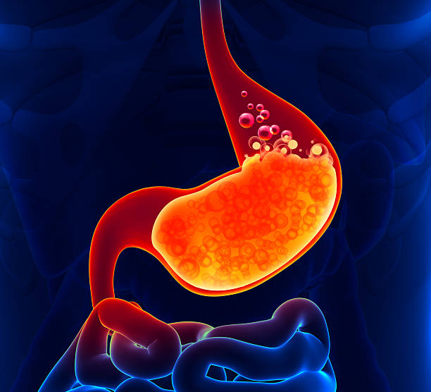 What are the Symptoms of Low Stomach Acid and the Treatment for Low Stomach Acid?