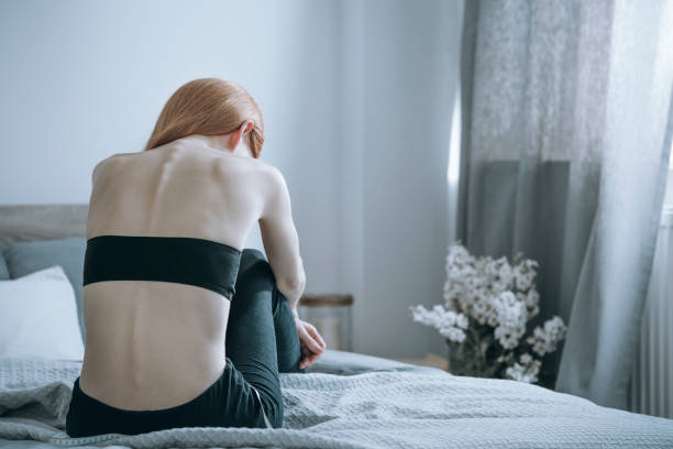 What are the Symptoms of Anorexia Nervosa and the Treatment for Anorexia Nervosa?