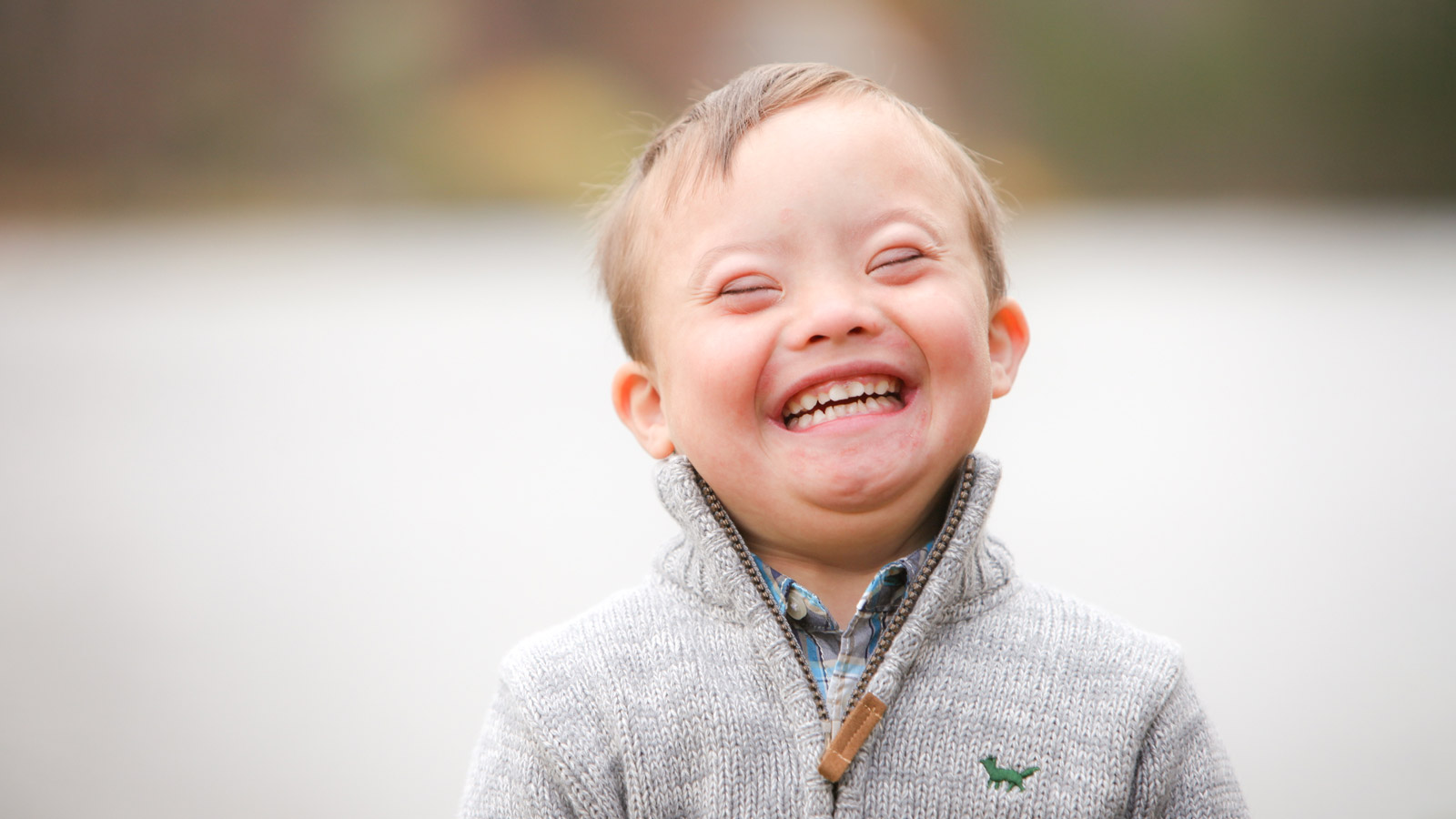 What are the Symptoms of Down Syndrome and the Treatment for Down Syndrome ?