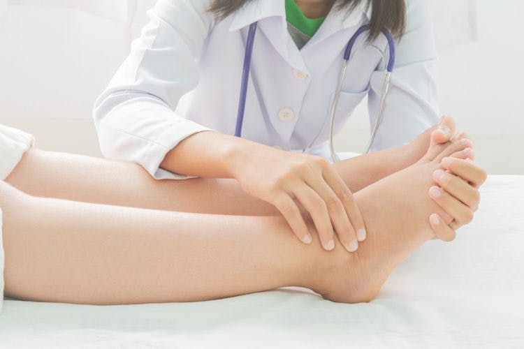 What are the Symptoms of Leg Swelling and the Treatment for Leg Swelling?