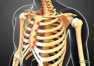 What are the Symptoms of Costochondritis and the Treatment for Costochondritis?