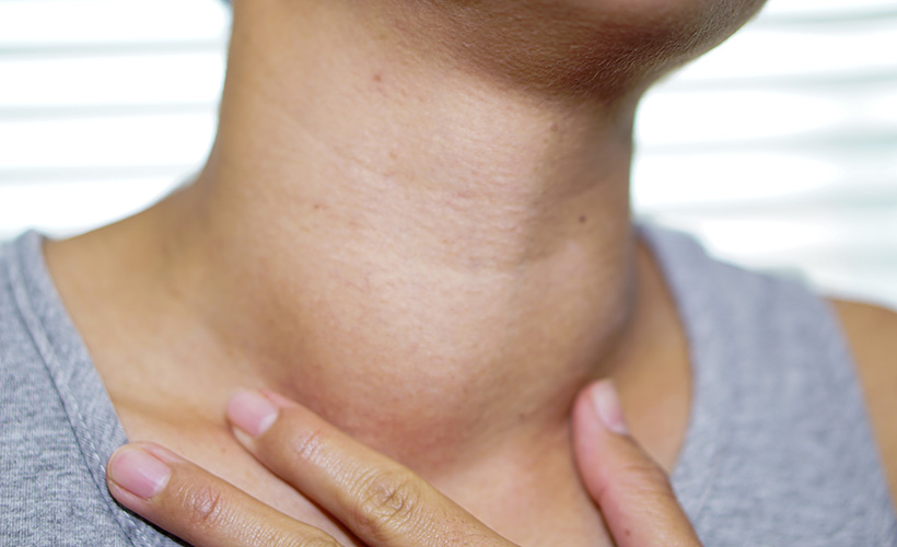 What are the Symptoms of Overactive Thyroid and the Treatment for Overactive Thyroid?