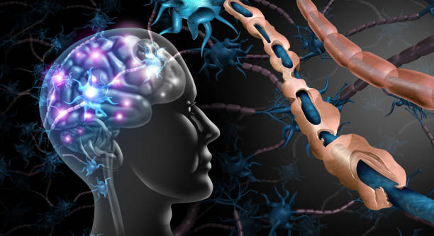 What are the Symptoms of Multiple Sclerosis and the Treatment for Multiple Sclerosis?