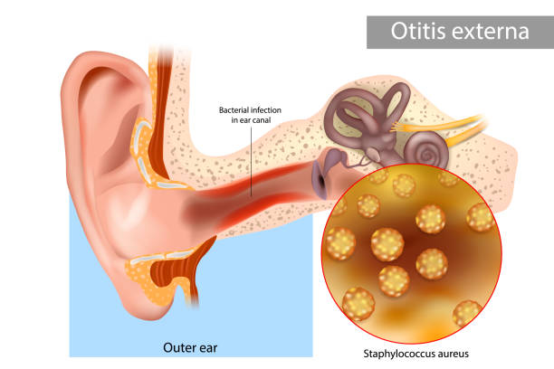 What are the Symptoms of Middle Ear Infection and the Treatment for Middle Ear Infection?