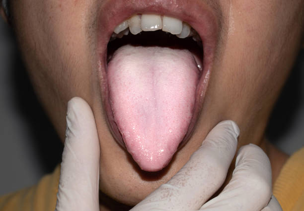 What are the Symptoms of Metallic Taste in Mouth and Fatigue and the Treatment for Metallic Taste in Mouth and Fatigue?