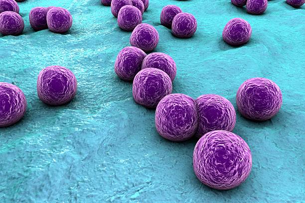 What are the Symptoms of Staphylococcus Aureus and the Treatment for Staphylococcus Aureus?