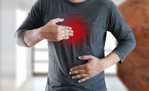 What are the Symptoms of Severe Heartburn and the Treatment for Severe Heartburn?
